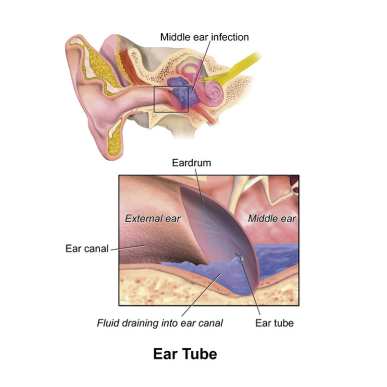 Ear, Nose and Throat - Coastal ENT